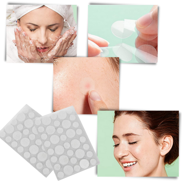 Invisible Acne Patches For Clearer Skin With Breathable Comfort 36 Pack