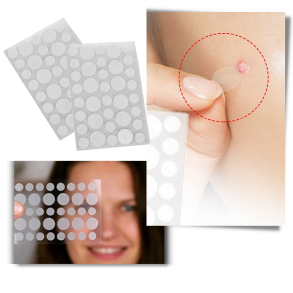 Invisible Acne Patches For Clearer Skin With Breathable Comfort 36 Pack
