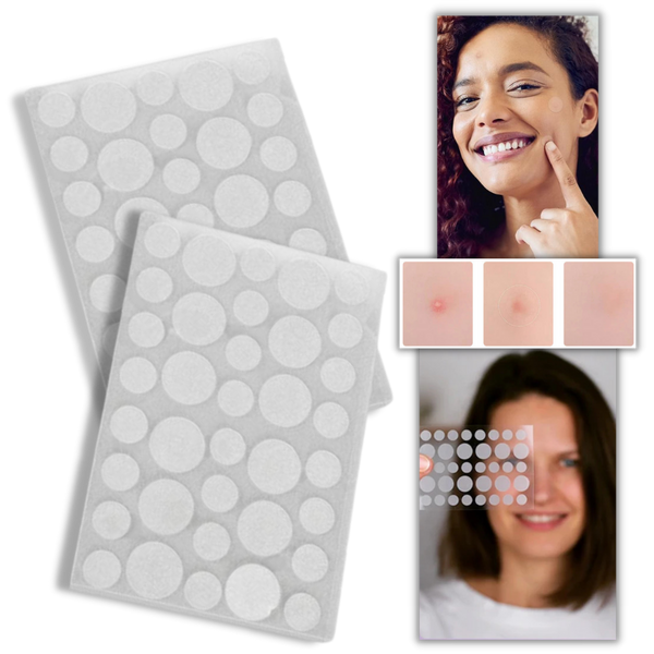 Invisible Acne Patches For Clearer Skin With Breathable Comfort 36 Pack