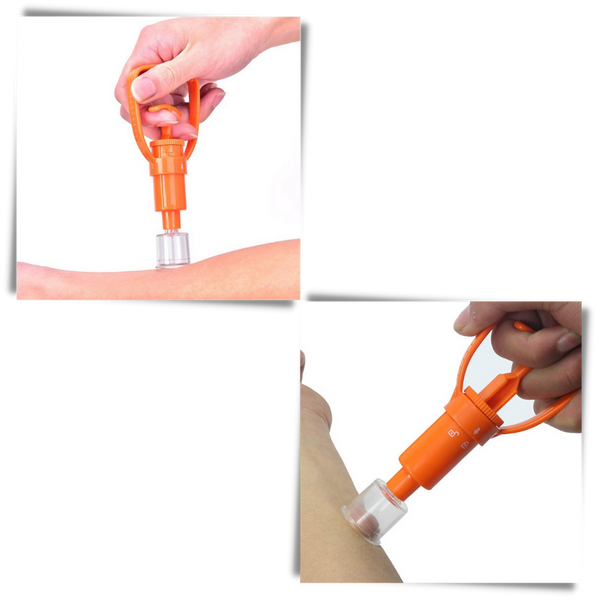 Essential Portable Venom Extraction Kit For Rapid Bite First Aid