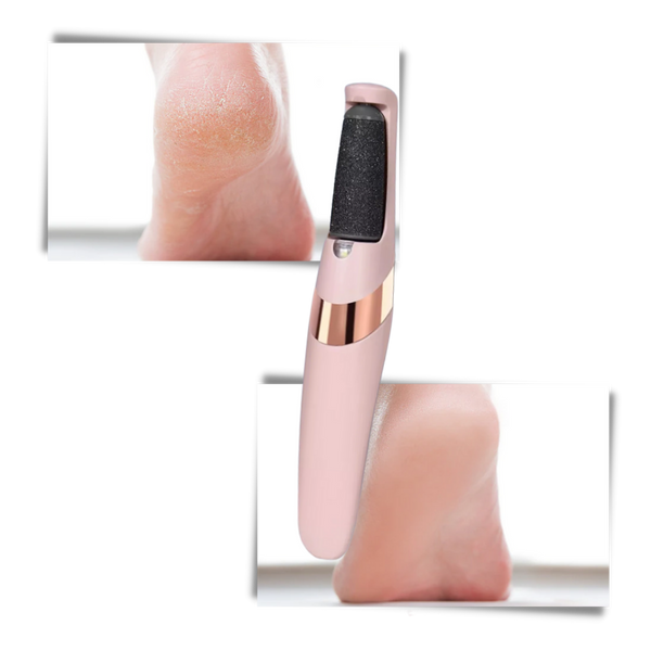 Rechargeable Electric Foot Callus Remover For Softer Feet