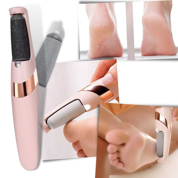Rechargeable Electric Foot Callus Remover For Softer Feet