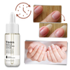 Nail Repair Serum For Rapid Nourishment And Healthy Nails