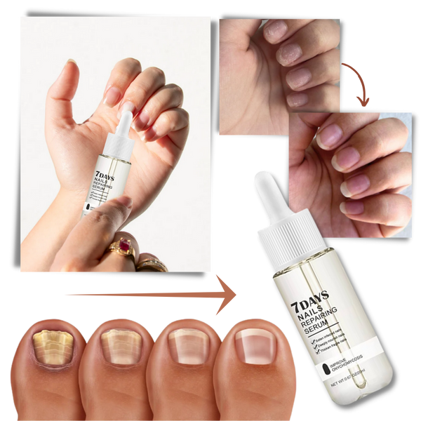 Nail Repair Serum For Rapid Nourishment And Healthy Nails