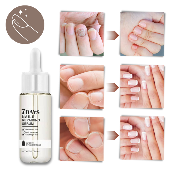 Nail Repair Serum For Rapid Nourishment And Healthy Nails