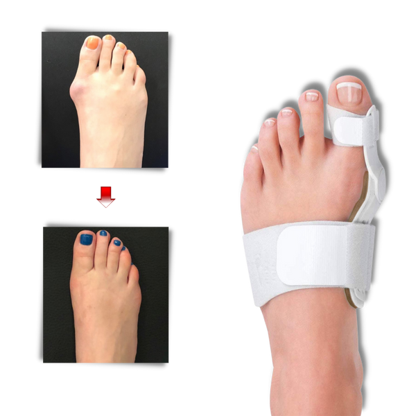 Bunion Corrector Orthotic For Toe Alignment And Pain Relief