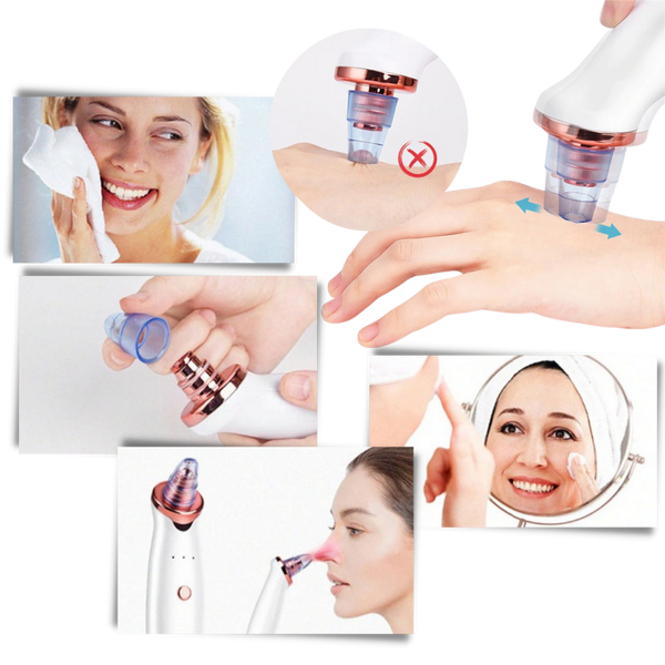 Pore Vacuum For Blackhead Removal And Clearer Smoother Skin