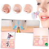 Pore Vacuum For Blackhead Removal And Clearer Smoother Skin