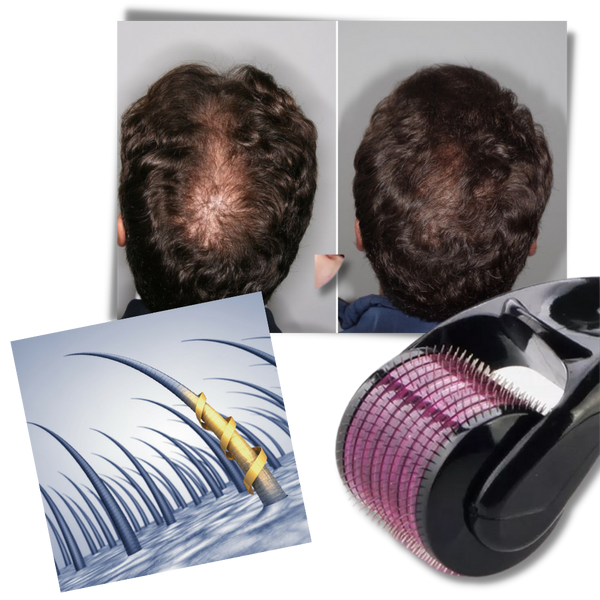Derma Roller For Hair And Beard Growth And Scalp Health