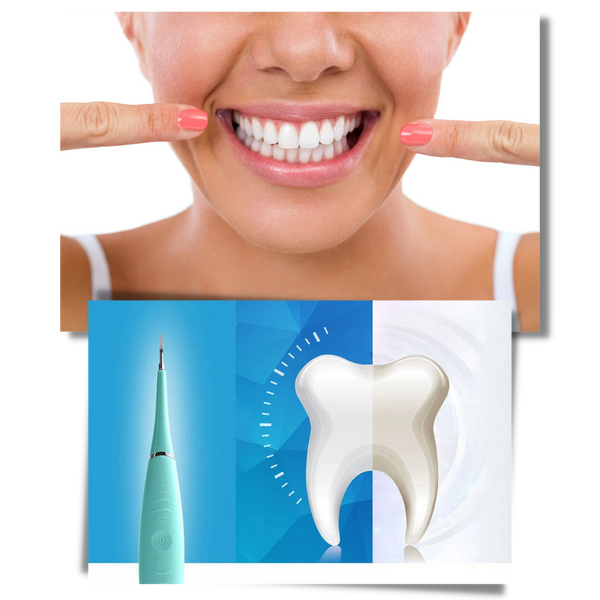 Ultrasonic Dental Tartar Remover For Deep Cleaning And Stain Removal