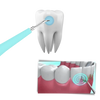 Ultrasonic Dental Tartar Remover For Deep Cleaning And Stain Removal