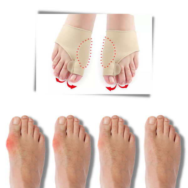 Gel Bunion Corrector With Toe Separator For Pain Relief And Comfort