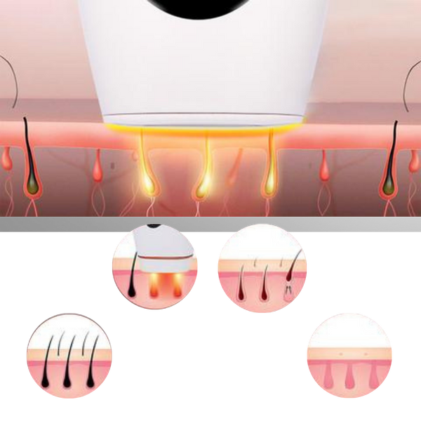 IPL Hair Removal Handset Featuring 8 Intensity Levels For Painless Results