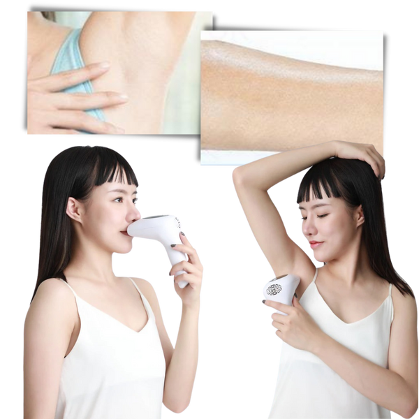 IPL Hair Removal Handset Featuring 8 Intensity Levels For Painless Results