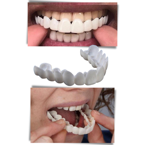 Reusable Dental Veneer Shields for a Natural, Pain-Free Smile