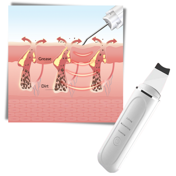 Premium Ultrasonic Facial Cleansing Device for Clear Radiant Skin