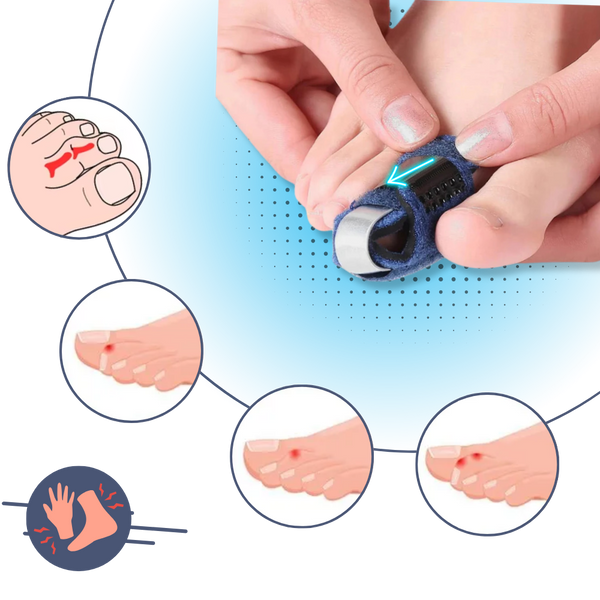 Adjustable Toe Straightener For Pain Relief And Realignment