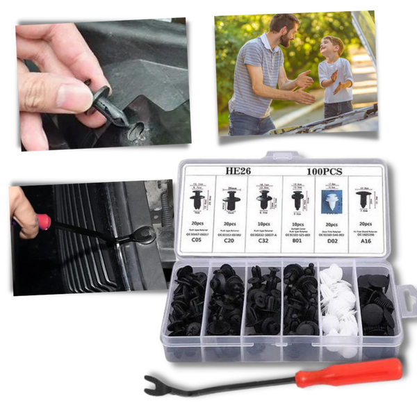 Car Door Panel Clip Kit Universal Fit For Easy Installation