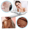 Blue Laser Pen for Dark Spots and Hyperpigmentation Reduction