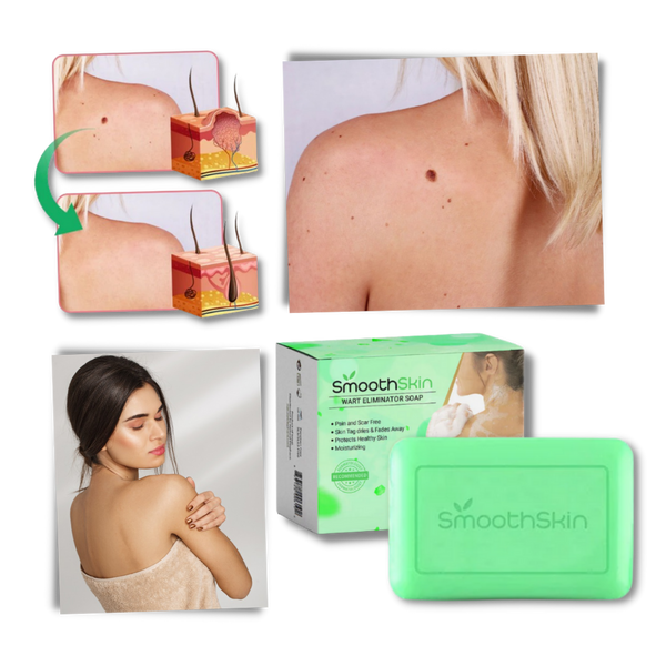 Moisturizing Exfoliator Soap For Wart Removal And Skin Renewal
