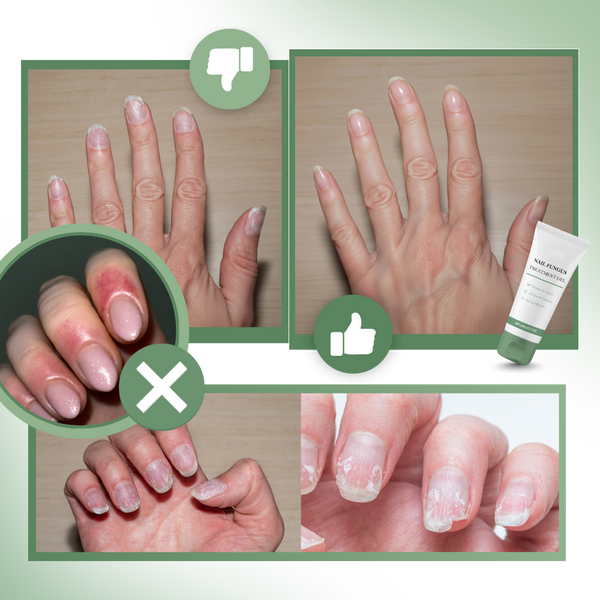 Nail Hydration Gel For Revitalized Smooth Nails And Conditioning