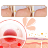 Gentle Skin Tag Removal Solution For Quick Pain Free Results