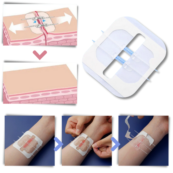 Waterproof Wound Adhesive Patch For Quick Hemostasis And Secure Seal