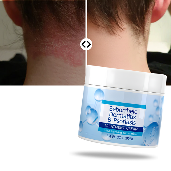 Hydrating Scalp Cream Delivers Deep Moisture And Soothing Relief