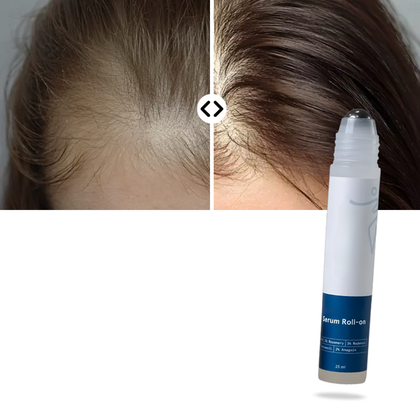 Scalp Nourishing Roll On Serum For Stronger Roots And Fuller Hair