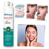 Acne Scar Repair Spray for Smoother More Even Skin Tone
