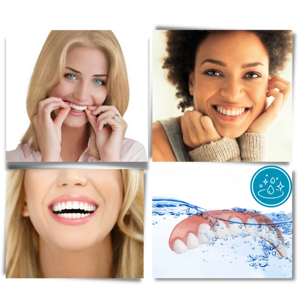 Custom Fit Snap On Veneers For Instant Natural Smile