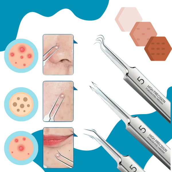 Multifunctional Precision Pointed Tweezers Set For Flawless Skin