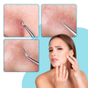 Multifunctional Precision Pointed Tweezers Set For Flawless Skin