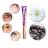 High Frequency Eye Rejuvenation Device For Firming And Brightening