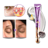 High Frequency Eye Rejuvenation Device For Firming And Brightening
