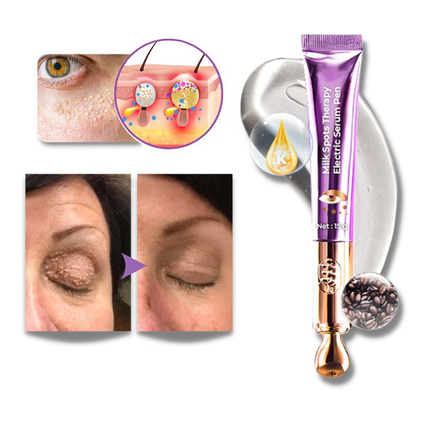 High Frequency Eye Rejuvenation Device For Firming And Brightening