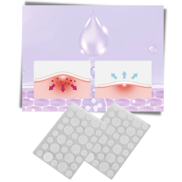 Invisible Acne Patches For Clearer Skin With Breathable Comfort 36 Pack