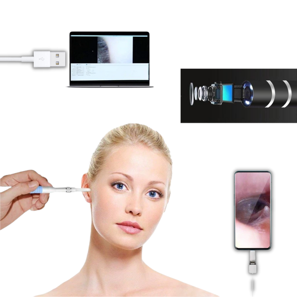 Three In One Ear Inspection Camera With 720P HD View And LED Light