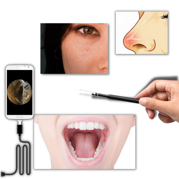 Three In One Ear Inspection Camera With 720P HD View And LED Light