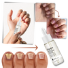 Nail Repair Serum For Rapid Nourishment And Healthy Nails