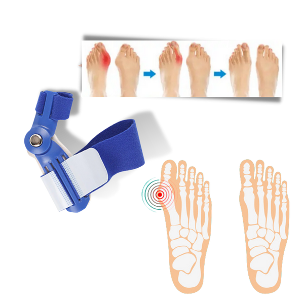 Bunion Corrector Orthotic For Toe Alignment And Pain Relief