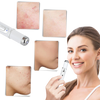 Blue Light Therapy Pen For Varicose And Spider Vein Reduction