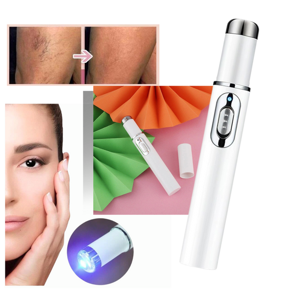 Blue Light Therapy Pen For Varicose And Spider Vein Reduction
