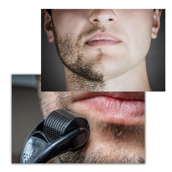 Derma Roller For Hair And Beard Growth And Scalp Health