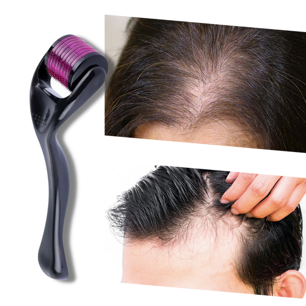 Derma Roller For Hair And Beard Growth And Scalp Health