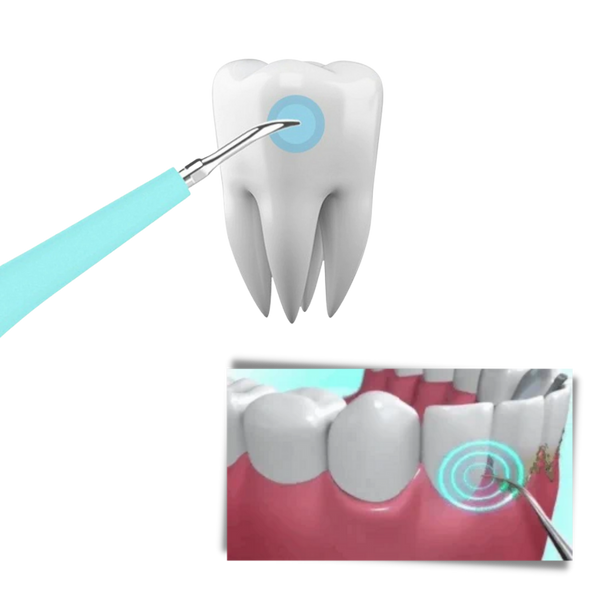 Ultrasonic Dental Tartar Remover For Deep Cleaning And Stain Removal