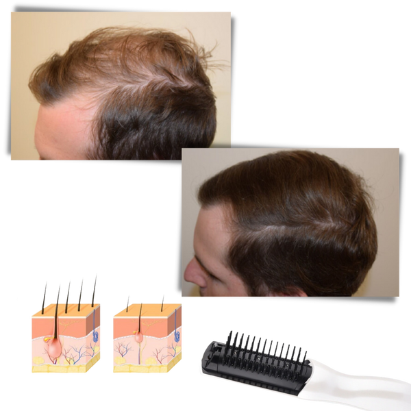 Infrared Laser Comb For Stronger, Thicker Hair And Scalp Stimulation
