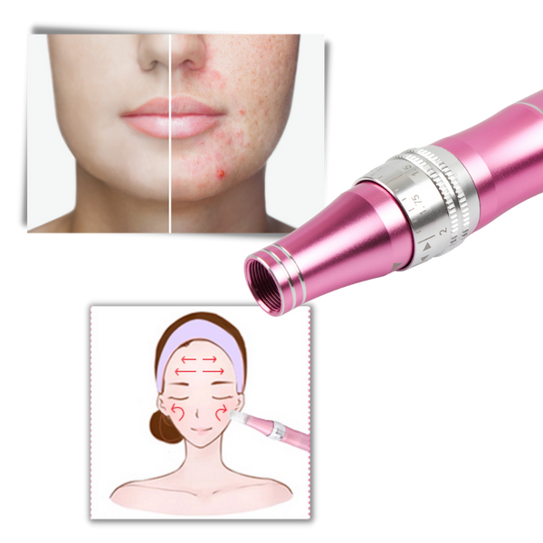 Precision Microneedling Pen For Acne Scar Reduction And Radiant Skin