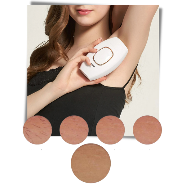 Premium Compact IPL Hair Removal Device For Long Lasting Painless Results