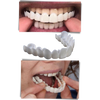 Reusable Dental Veneer Shields for a Natural, Pain-Free Smile